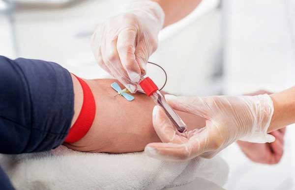 Why Is Blood Donation Important? Benefits and Impact Explained
