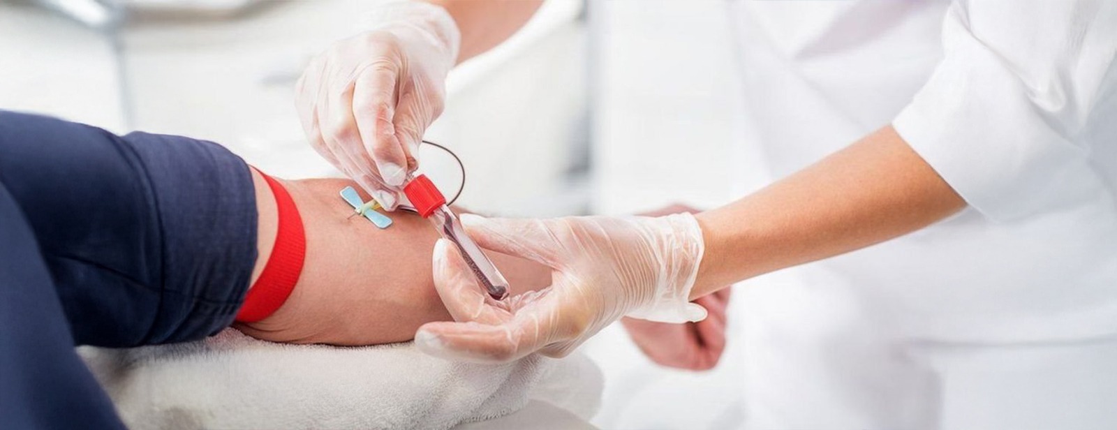 Why Is Blood Donation Important? Benefits and Impact Explained
