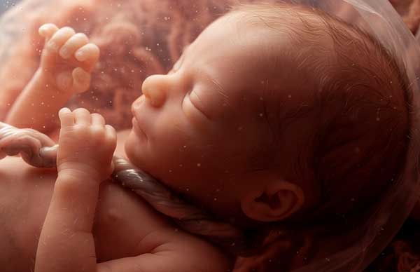 Nuchal Cord and Perinatal Outcome